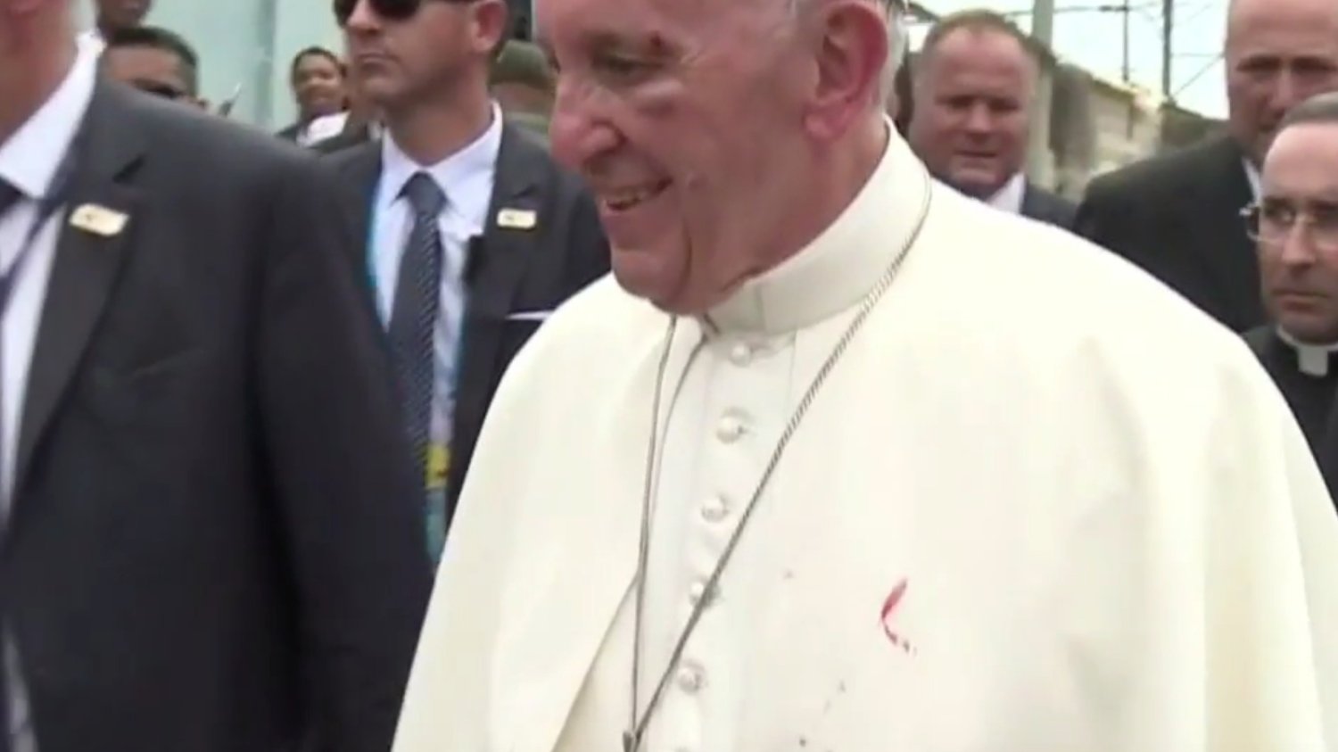 Papież Franciszek pomimo obrażeń nie stracił uśmiechu.