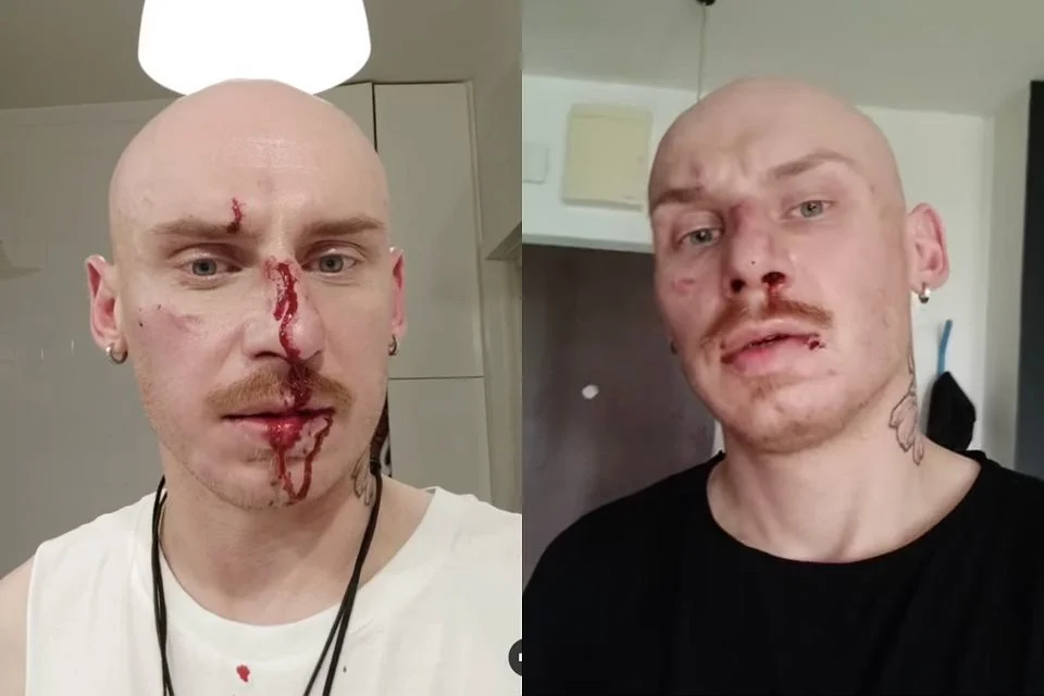 na zdjęciu b. fryzjer prezydenta Dudy, pobity za to, że jest gejem