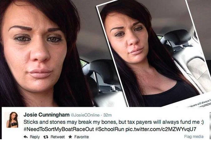 Josie Cunningham na koszt brytyjskiego podatnika powiększyła sobie piersi