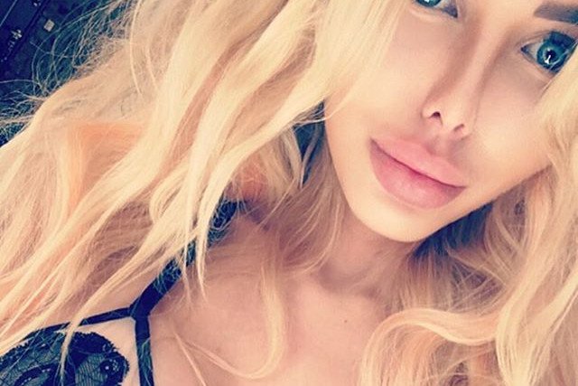 Temat powiększania ust powrócił za sprawą występu "polskiej Barbie" w "Dzień dobry TVN"