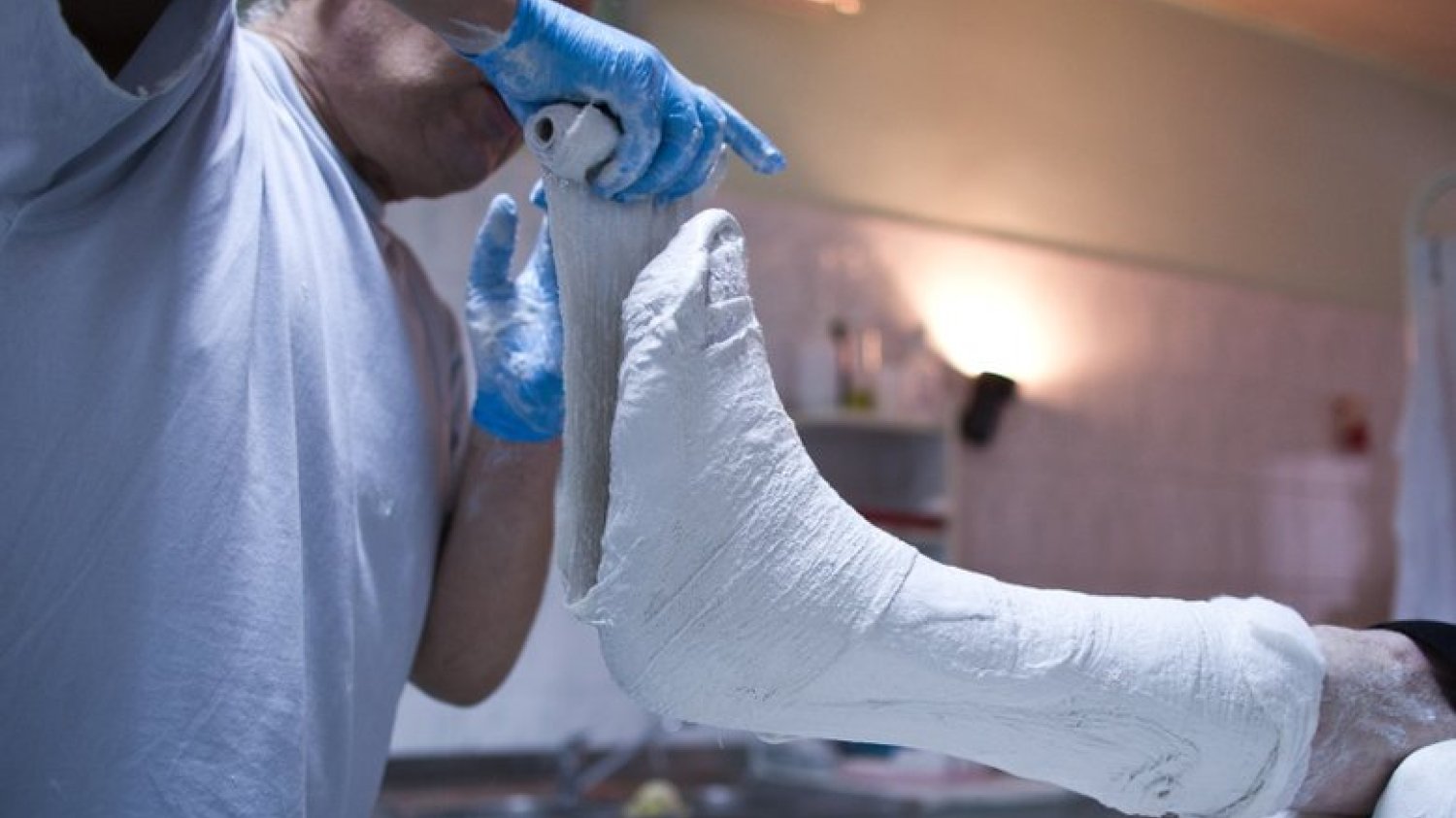 Osteoporoza może być przyczyną kalectwa u kobiet po 50. roku życia.