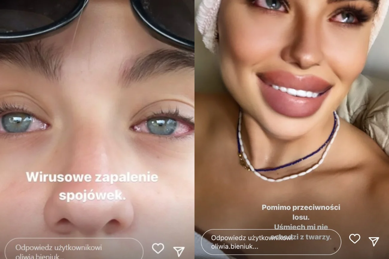 Oliwia Bieniuk ma problemy z oczami. Cierpi na zapalenie spojówek