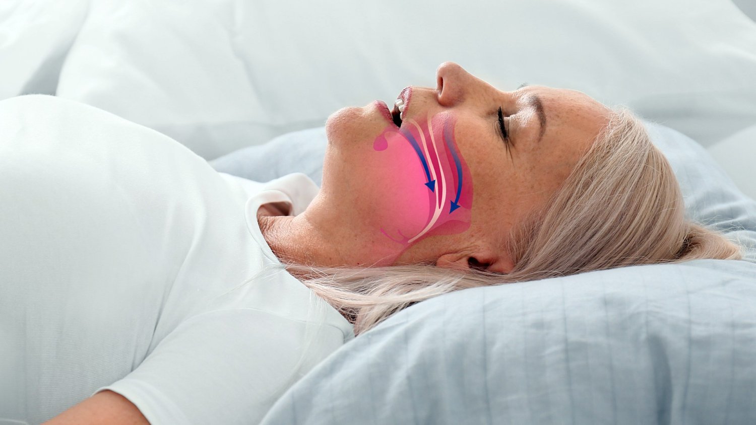 15 marca Dniem Walki z Chrapaniem. Lekarze mówią jasno – to nie tylko kwestia hałasu