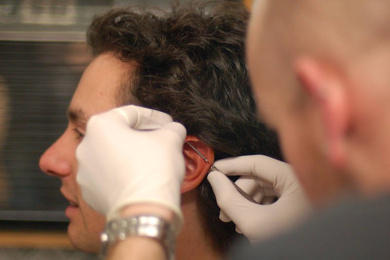 Profesjonalny piercing jest jak zabieg chirurgiczny. Narzędzia muszą być sterylne, a skóra wydezynfekowana