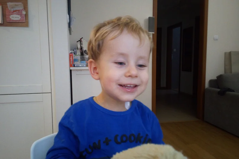Wojtek ma 2 lata, choruje na siatkówczaka - nowotwór oczu.