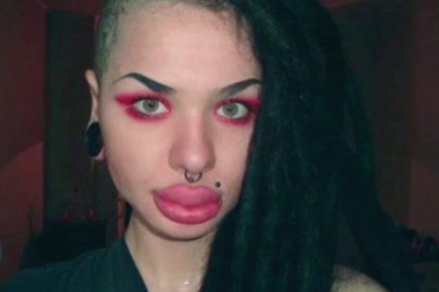 Nieudane operacje plastyczne to temat, który porusza program "Plastyczna Fuszerka" emitowany na kanale E!. Start drugiego sezonu 26 kwietnia o godzinie 21.00.