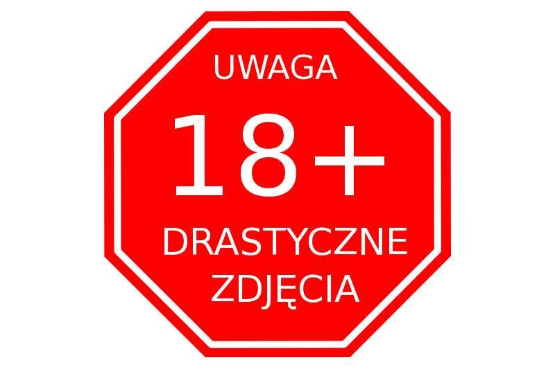 Dlaczego taki komunikat nie powstrzymuje nas przed klikaniem na zdjęcia ofiar ze Smoleńska?