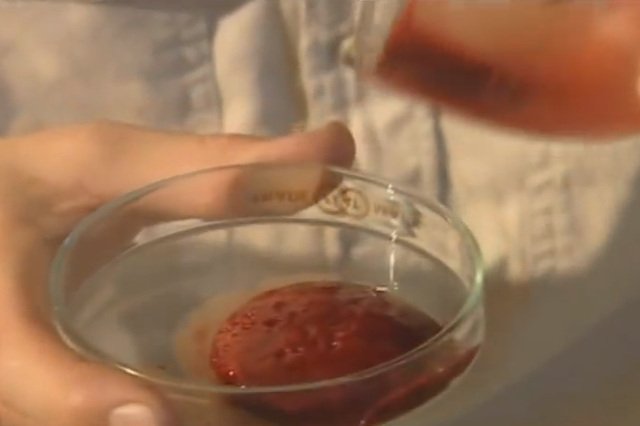 Jad daboi łańcuszkowej zamienia krew w czerwoną galaretę