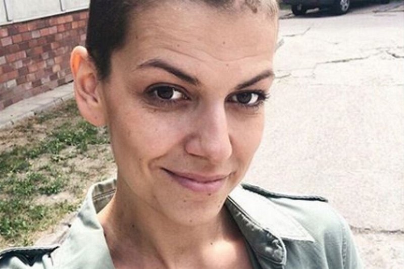 Aktorka zmagała się niedawno z tętniakiem.