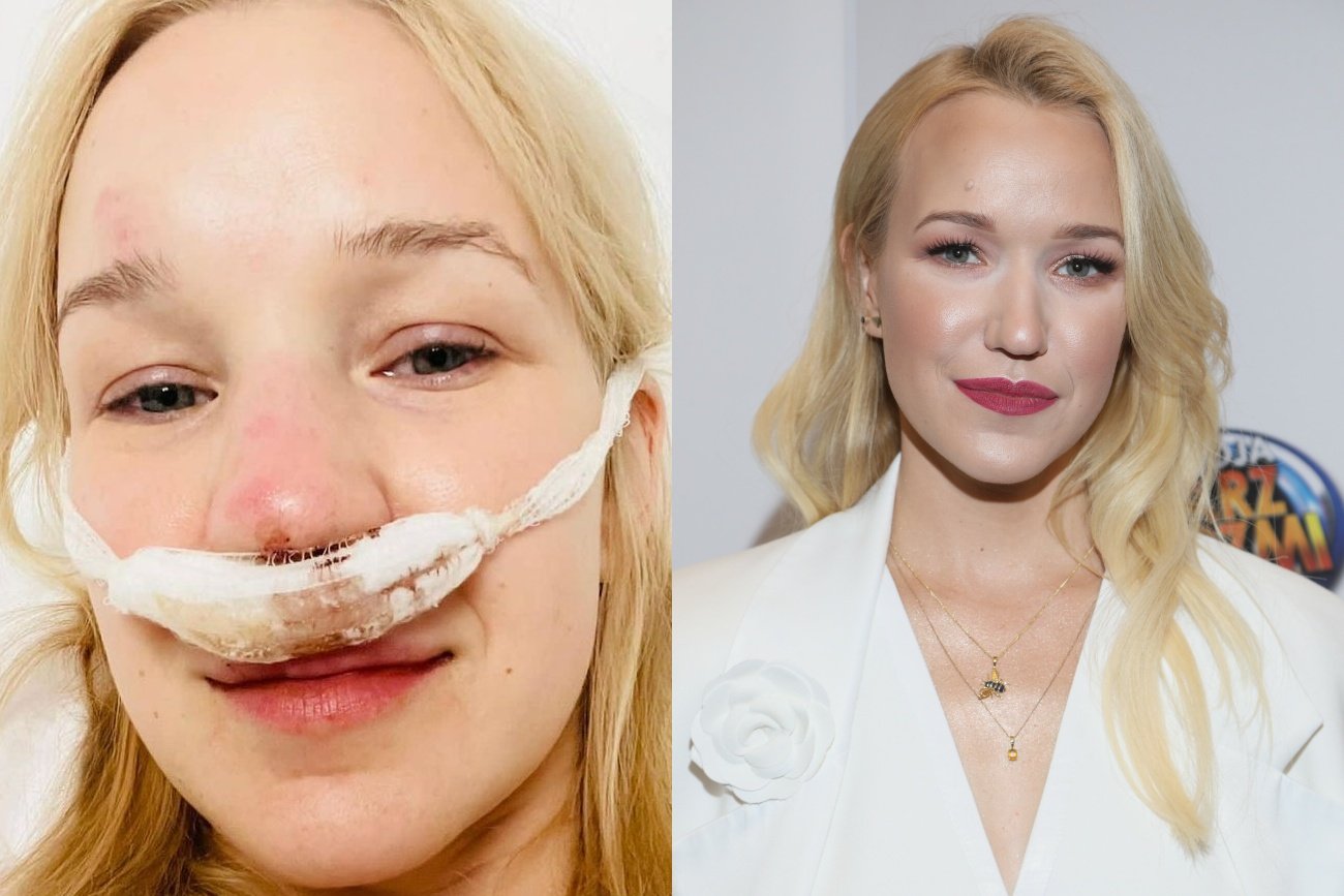 Dramat siostrzenicy Mateusza Morawieckiego. Miała poważny wypadek