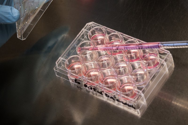 Ważna decyzja UE: Organizm, który nie może samodzielnie się rozwijać, nie jest embrionem