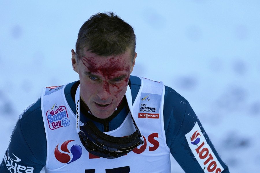 Upadek Piotra Żyły był bardzo dramatyczny