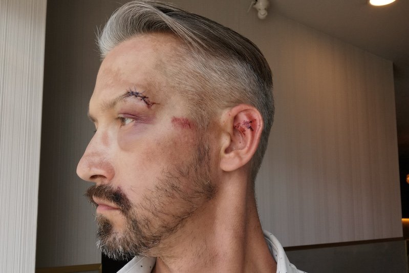 Hubert Centkowski został pobity przez mężczyznę, przed którym bronił jego żonę.