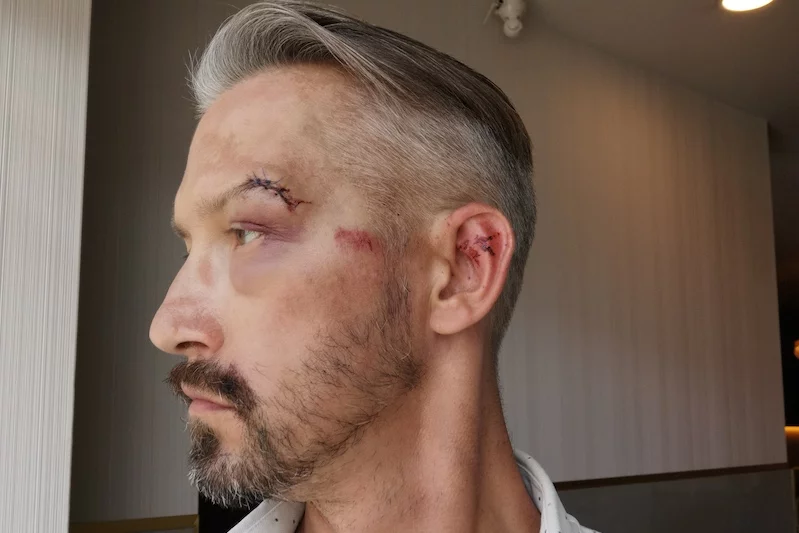 Hubert Centkowski został pobity przez mężczyznę, przed którym bronił jego żonę.