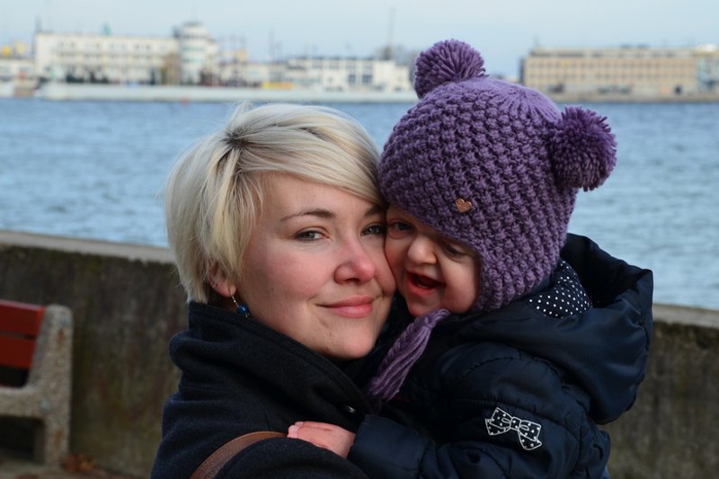 "Nasza Sówka" czyli 2,5 letnia Marta z Zespołem Aperta. "Mąż miał łzy w oczach, gdy ją zobaczył"