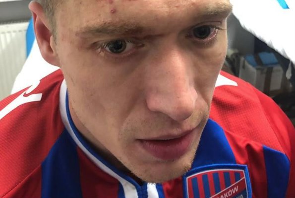 Piotr Malinowski okupił triumf nad Legią poważnym urazem głowy.