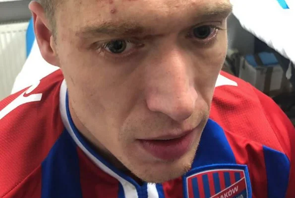 Piotr Malinowski okupił triumf nad Legią poważnym urazem głowy.