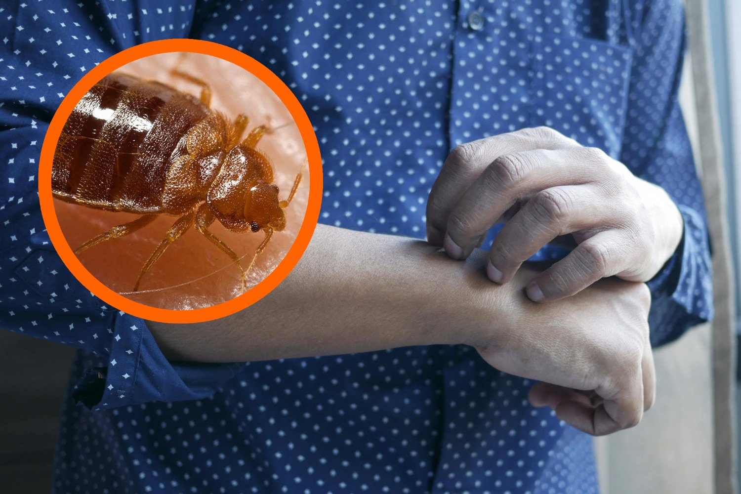 Pluskwy w domu. Jak je rozpoznać, gdzie są i jak je usunąć? Jak wygląda ugryzienie pluskwy? Tak je rozpoznasz na skórze