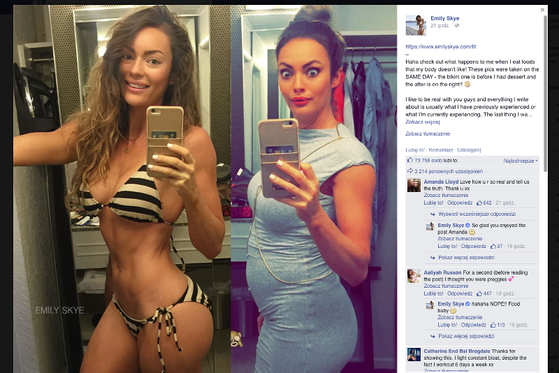 Emily Skye z ogromnyn dystansem pokazała problem wielu kobiet.