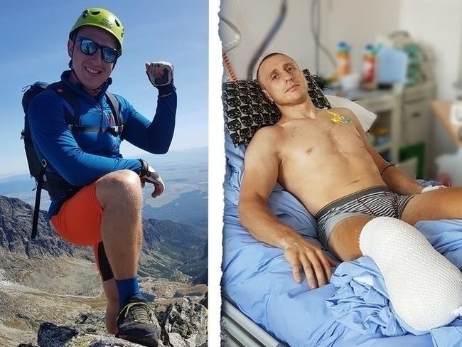 Szansą na powrót do sprawności po dramatycznym wypadku jest dla Bartka zakup protezy i żmudna rehabilitacja
