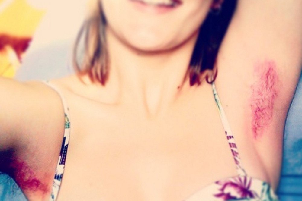 Protest kobiet: nie depilują pach, bikini oraz nóg, aby wesprzeć ofiary przemocy.