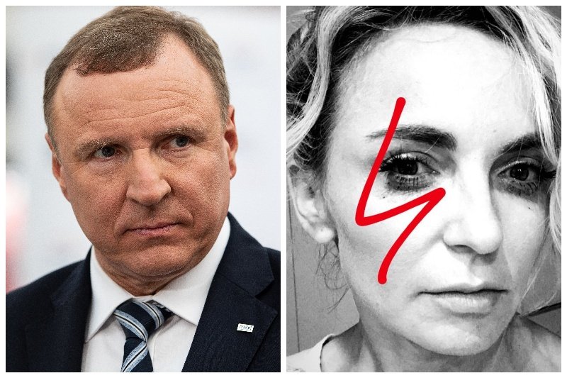 Anna Wyszkoni odpowiada na atak TVP.