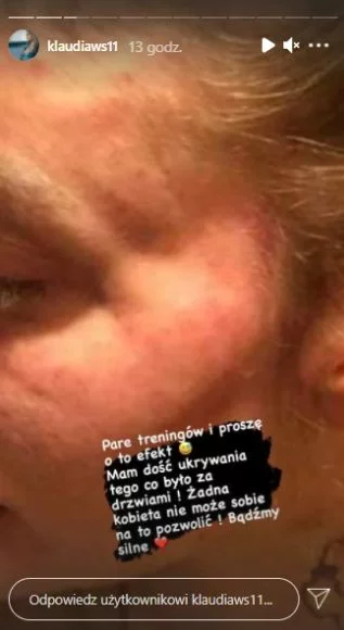Klaudia Stec została pobita?