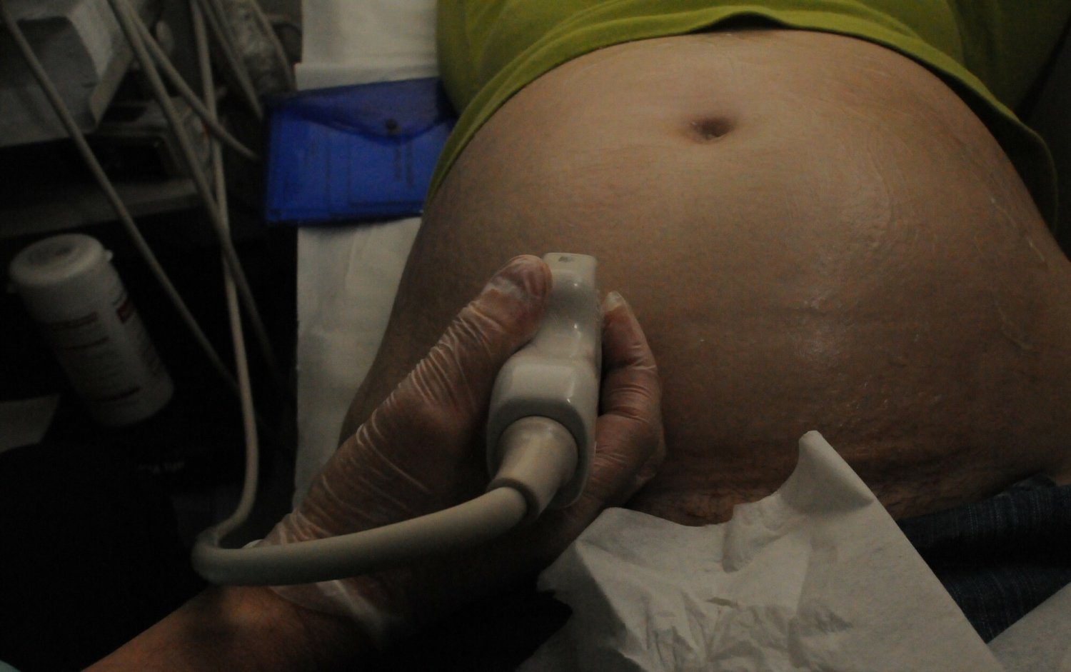 Prof. Marzena Dębska otrzymała w Niemczech nagrodę za dokonania w perinatologii (zdjęcie ilustracyjne)