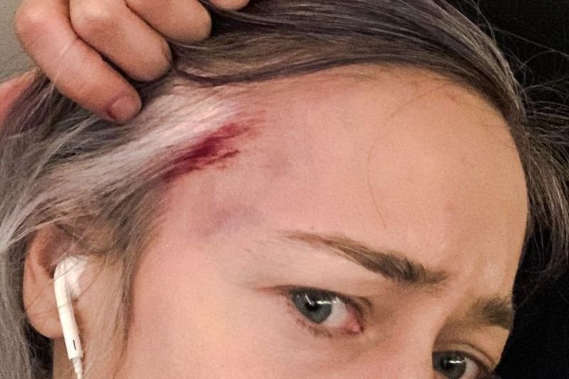 Matylda Damięcka oskarża policjanta o atak na proteście.