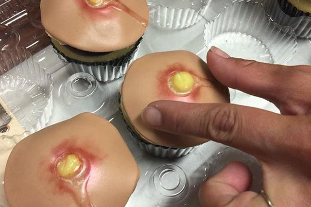 Babeczki - pryszcze tylko dla ludzi o silnych nerwach.