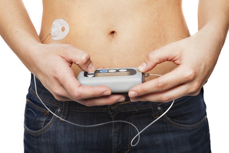 Pompa insulinowa to nie powód do wstydu