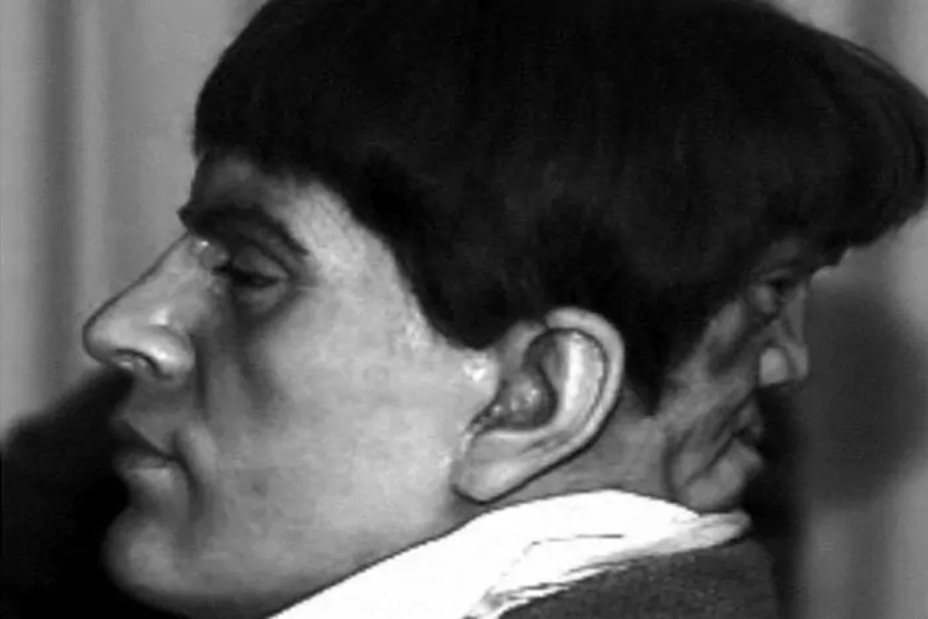 Edward Mordake - legenda człowieka o dwóch twarzach. Oto, ile jest w niej prawdy. Edward Mordake - legenda człowieka o dwóch twarzach. Oto, ile jest w niej prawdy.