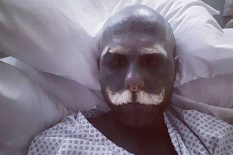 Polak przebywa w szpitalu w Londynie.