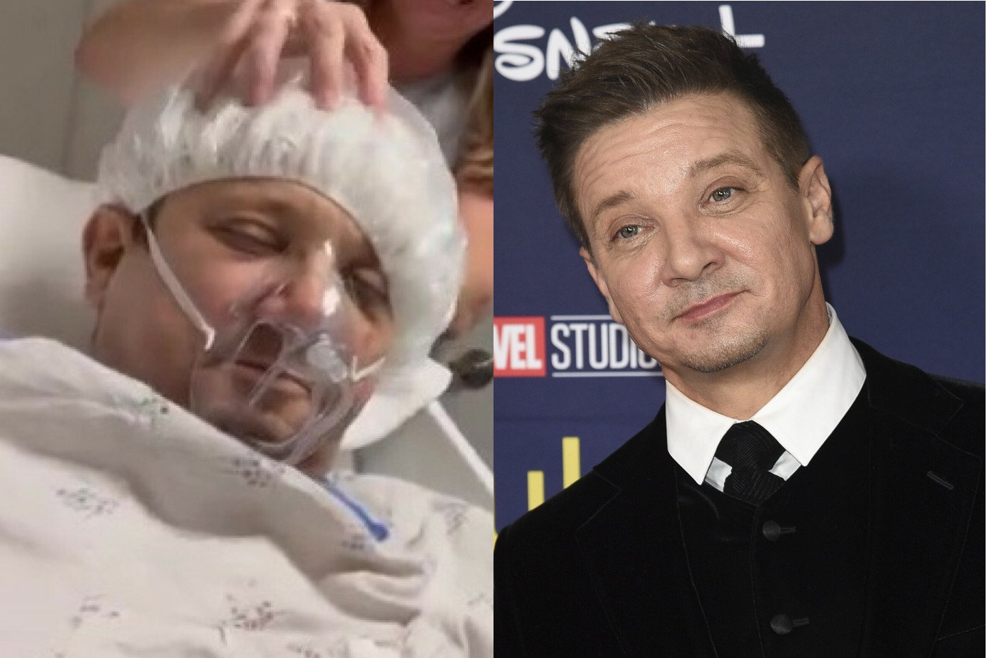 Jeremy Renner po wypadku