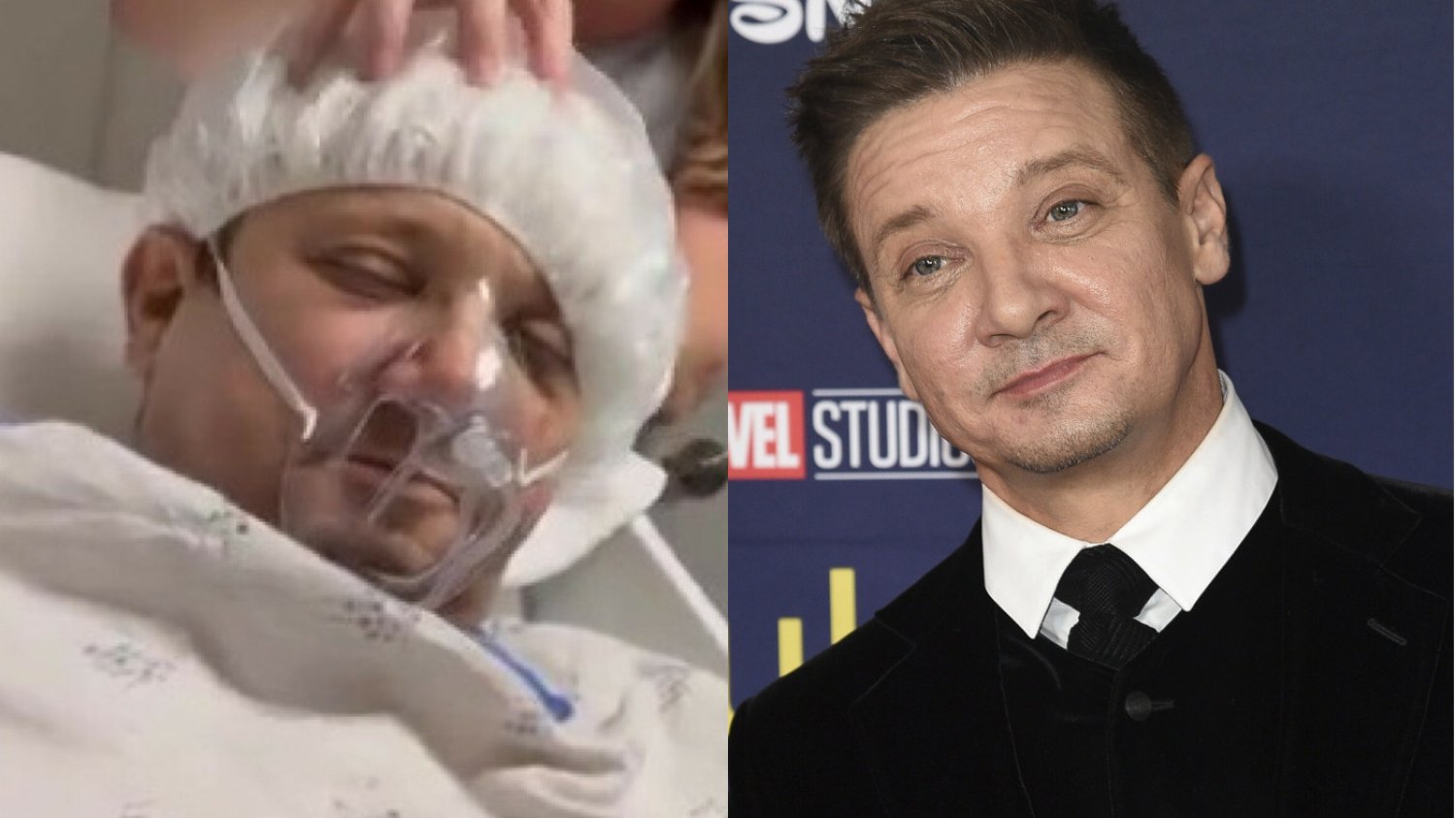 Jeremy Renner po wypadku