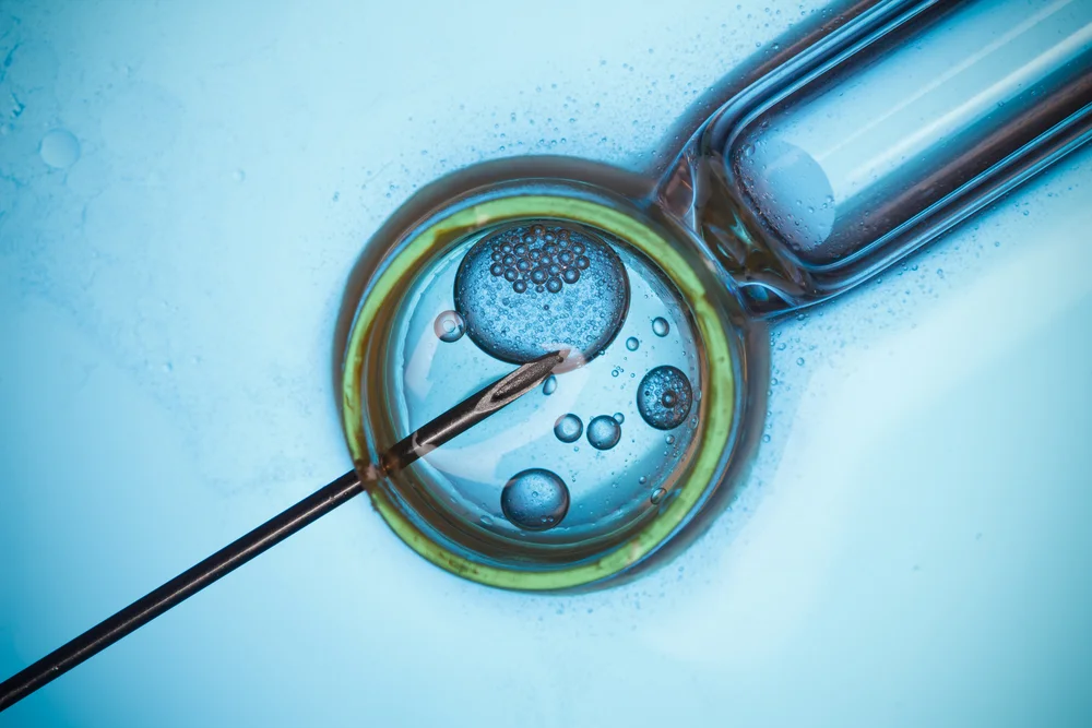 Zapłodnienie metodą in vitro