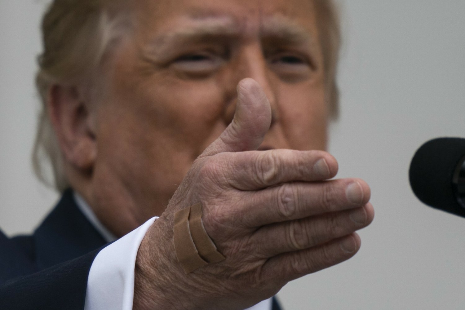 Potężny siniak na ręce Trumpa. Biały Dom zabrał głos