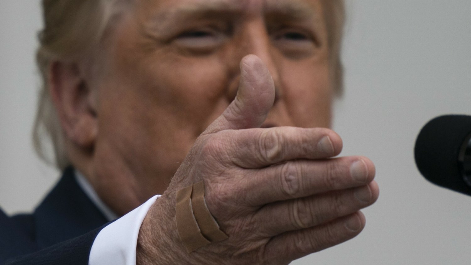 Potężny siniak na ręce Trumpa. Biały Dom zabrał głos