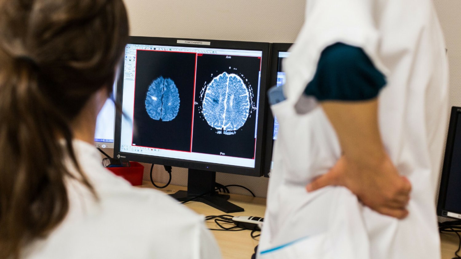 Społeczeństwo się starzeje i przybywa pacjentów z dolegliwościami neurologicznymi. Potrzebne są zmiany systemowe, bo neurologów mamy zbyt mało.