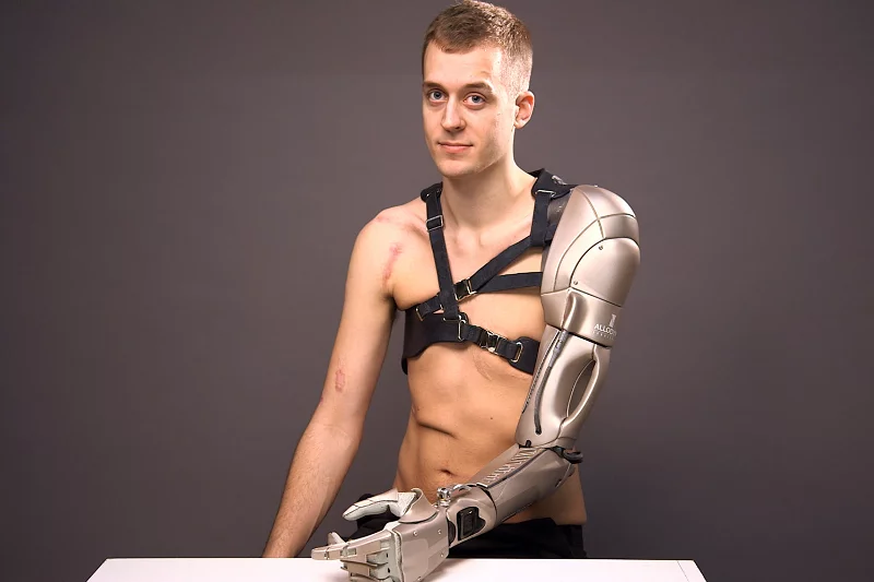 Renomowany producent gier komputerowych z Japonii obdarował poszkodowanego Brytyjczyka nowoczesną protezą wywołującą skojarzenia ze znanymi utworami science fiction