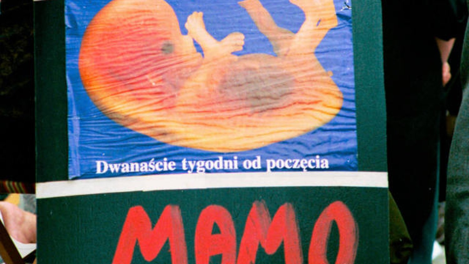 Jacek Januszewski przekonuje, że prawo nie powinno pozwalać na usuwanie ciąży, która jest wynikiem gwałtu