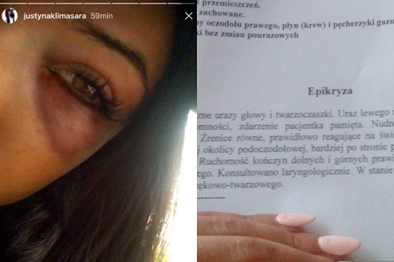 Kto stoi za pobiciem młodej działaczki SLD Justyny Klimasary?