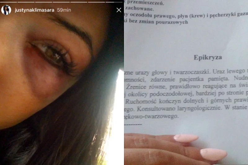 Kto stoi za pobiciem młodej działaczki SLD Justyny Klimasary?