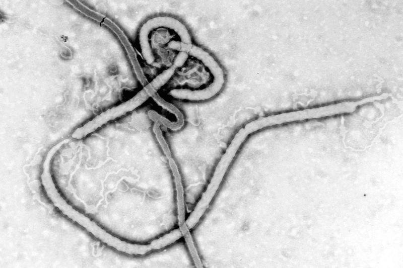 Wirus Ebola od początku roku zabił już 84 osoby. http://1.usa.gov/1mOPd8L