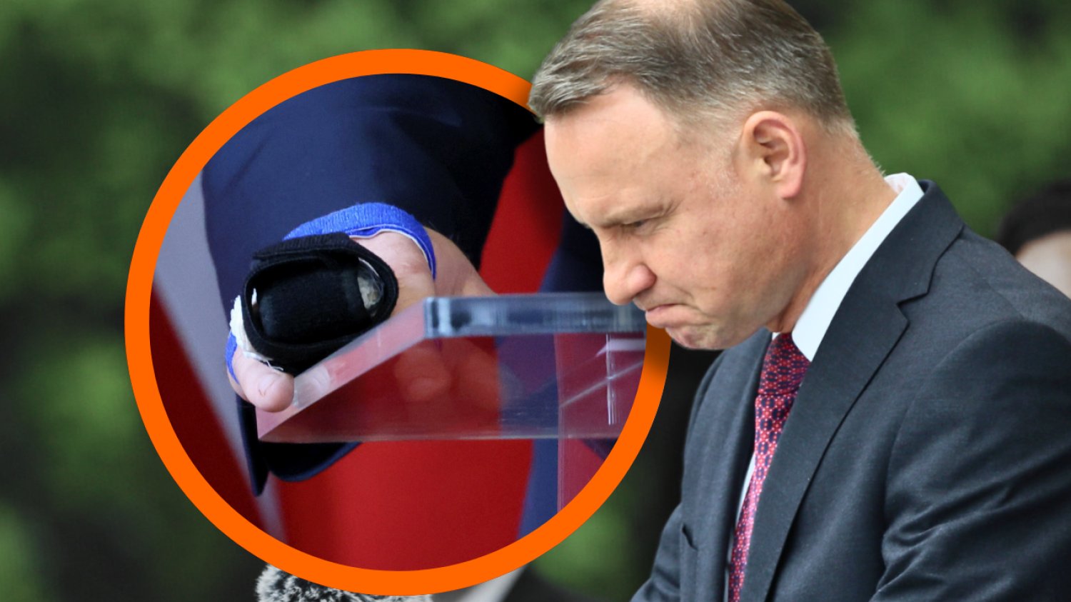 Palec prezydenta Dudy wygląda koszmarnie. Duda stracił koniuszek i paznokieć