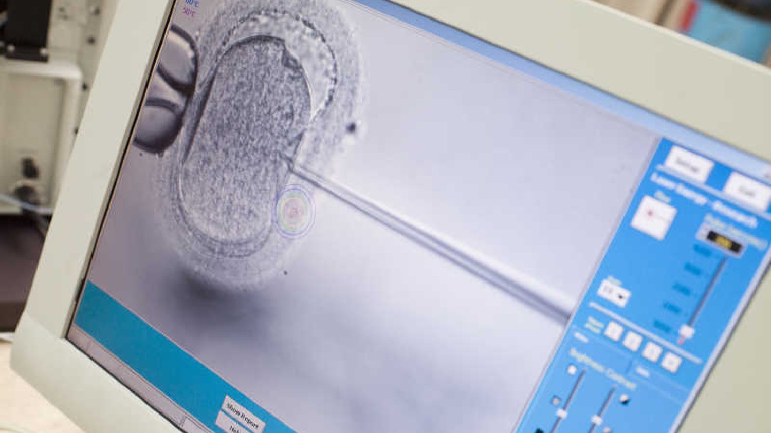 Jarosław Gowin zarzuca in vitro niską skuteczność. Ale przytacza dane, które zna chyba tylko on.