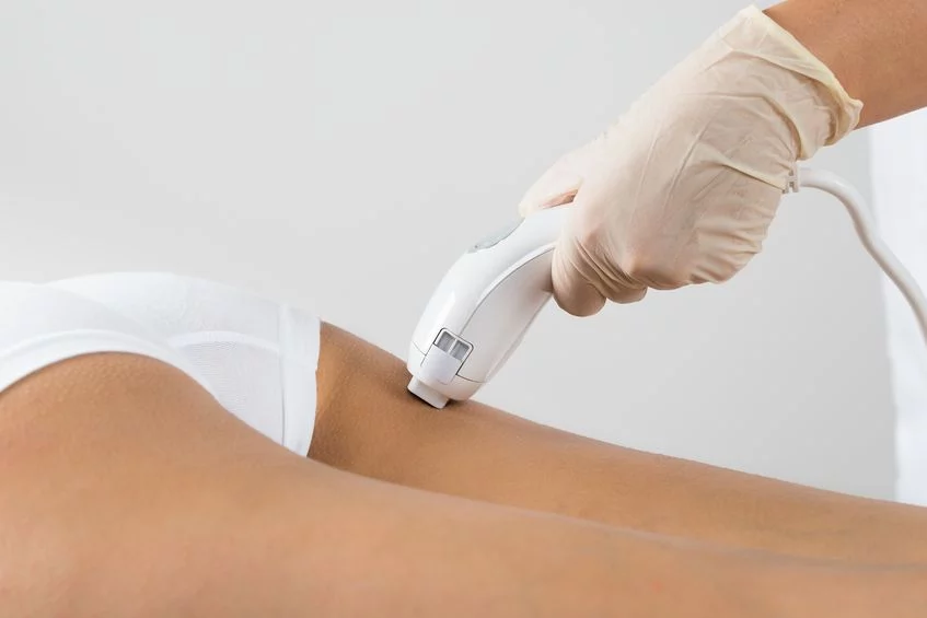 Epilacja IPL w salonie kosmetycznym
