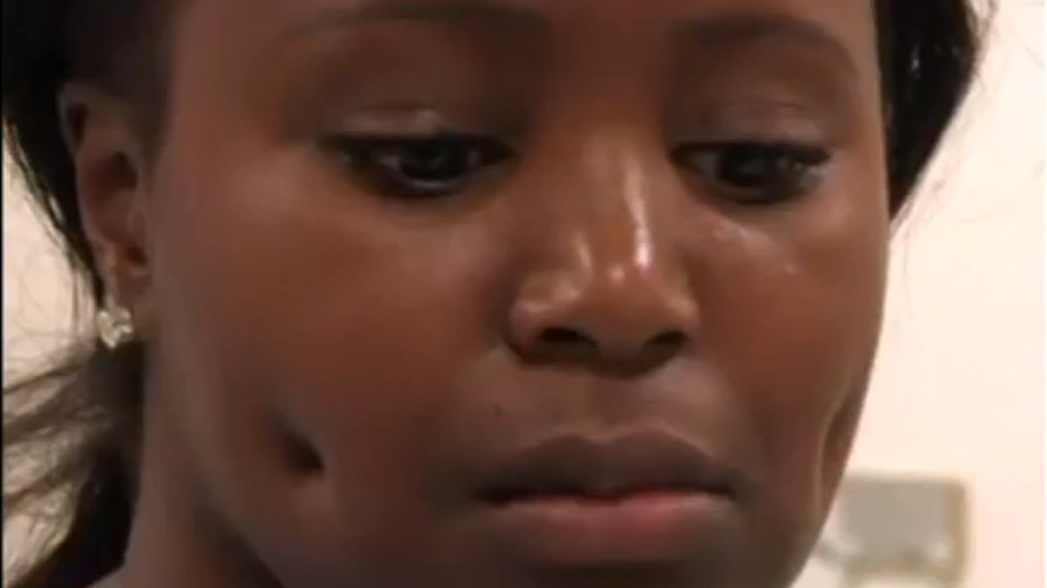 Cherelle Campbell niedługo po operacji