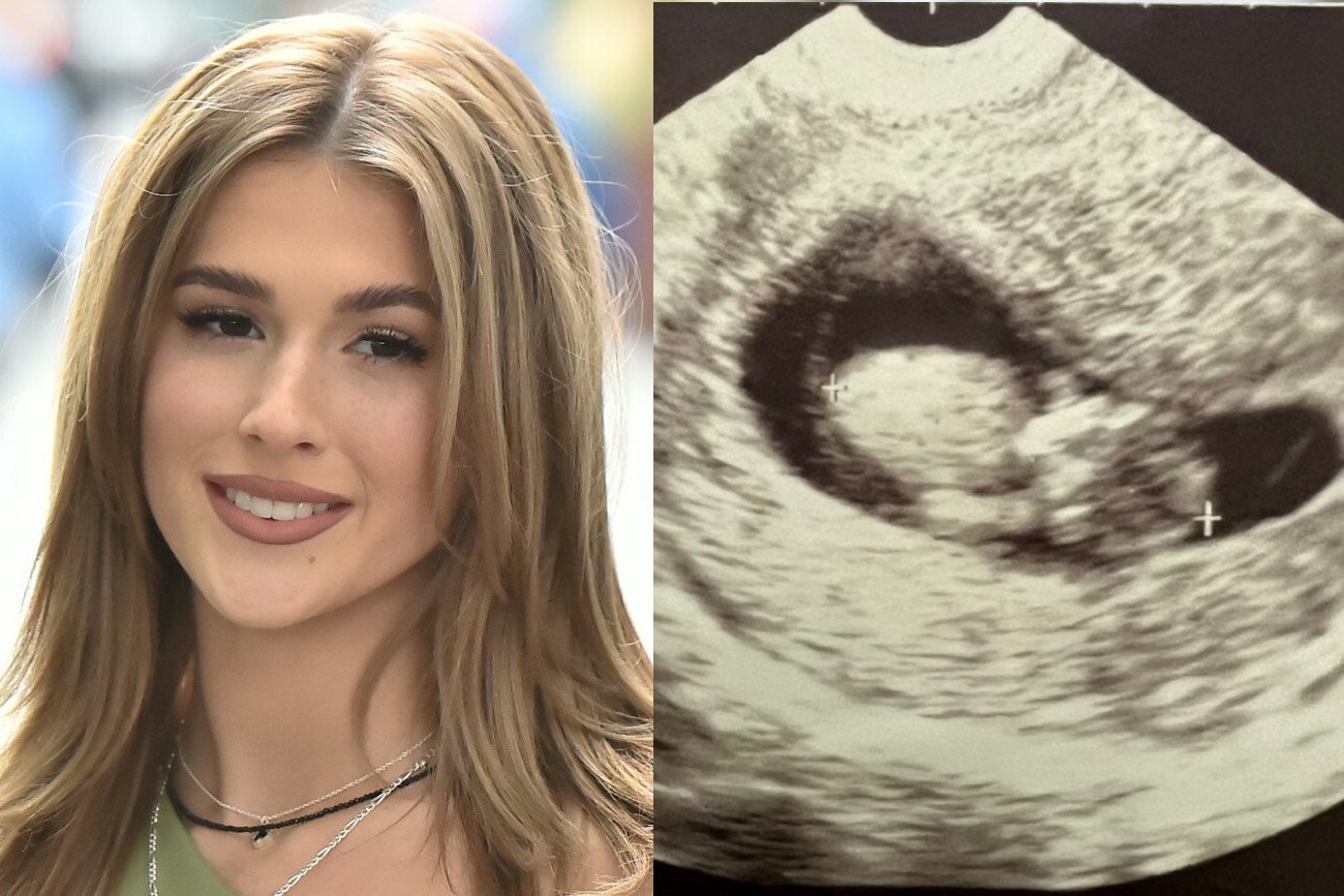 Roxie Węgiel pokazała zdjęcie USG. To specjalne życzenia od mamy.