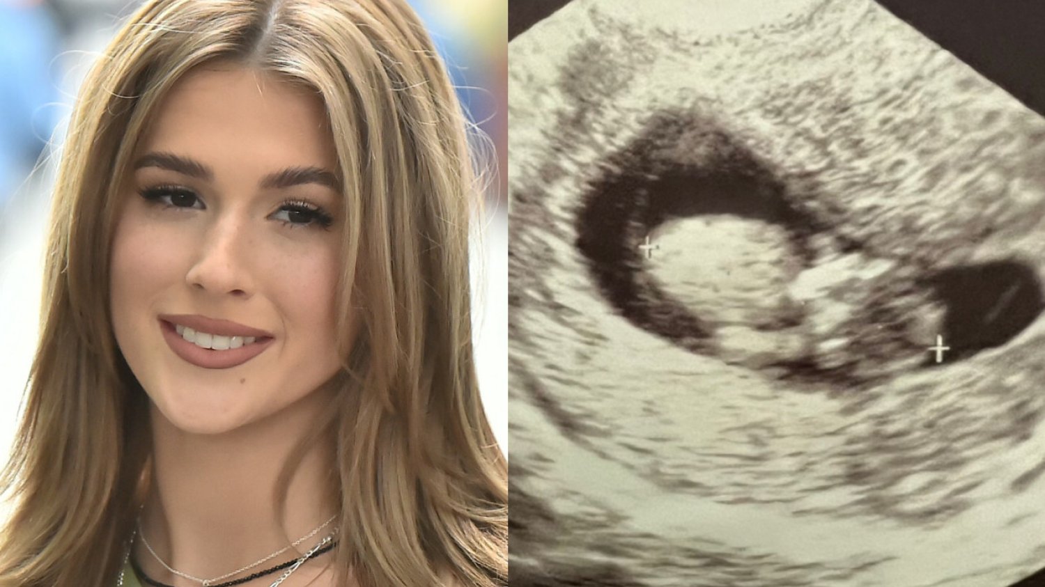 Roxie Węgiel pokazała zdjęcie USG. To specjalne życzenia od mamy.
